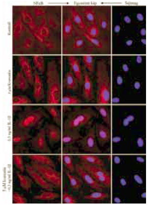 Természetes és szintetikus flavonoidok gyulladásgátló hatásának összehasonlítása in vitro endotélsejt modellen