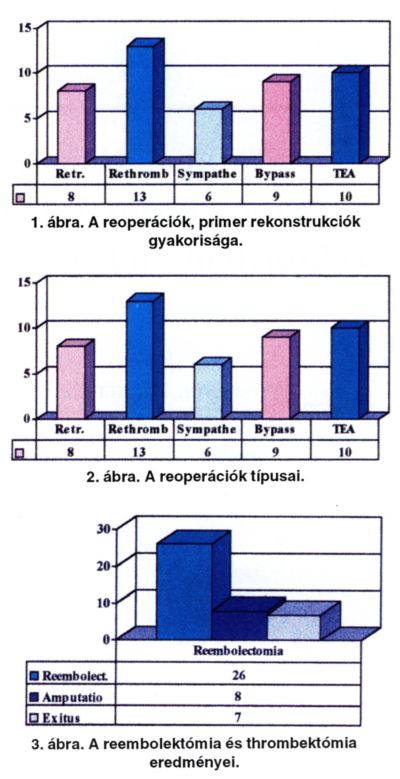 Az alsó végtag embolektómiája, trombektómiája során végzett primer rekonstrukciók és ezt követő reoperációk