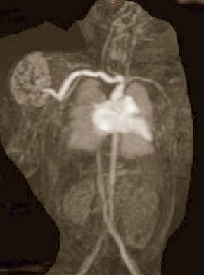 Cardiovascularis CT és MR diagnosztika gyermekkorban