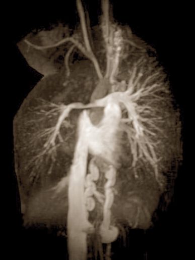 Cardiovascularis CT és MR diagnosztika gyermekkorban