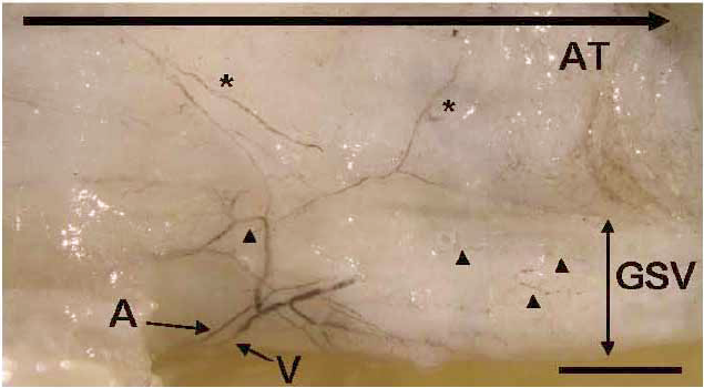 A v. saphena magna vasa vasorumainak anatómiája normális és patológiás körülmények között