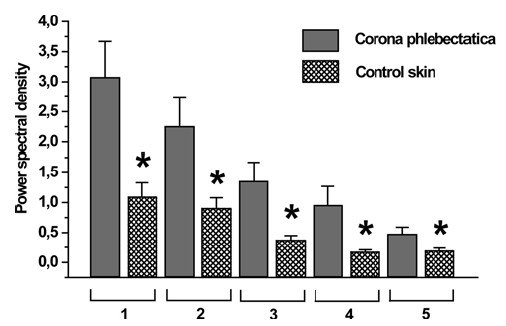 Corona phlebectatica paraplantaris mikrocirkulációjának vizsgálata