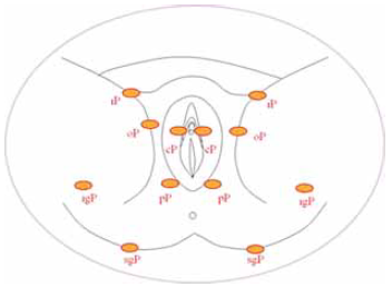 A krónikus vénás elégtelenség haemodynamikai ultrahang-térképezése: a söntök koncepciója