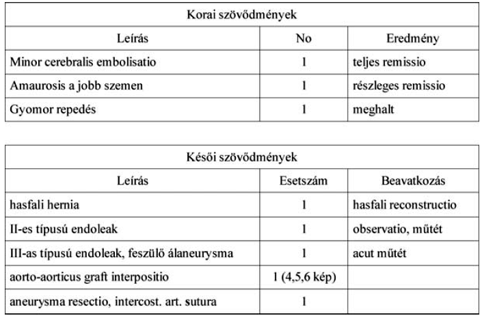 A mellkasi aorta penetráló atheromás ulcusa