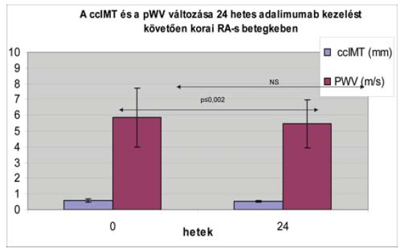 Artériás stiffness kutatások Angiológiai Tanszékünkön - Sikerek és csalódások