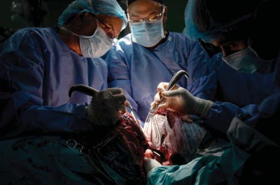 A bangladesi sziámi ikrek szétválasztása - II. rész